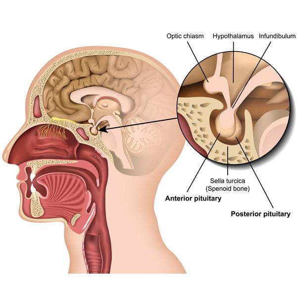 Master Gland Tumor
